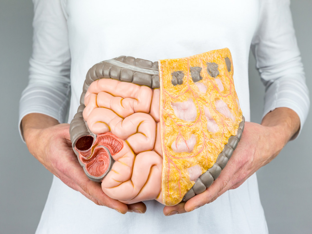 Digestive Issues & Problems | Dallas, TX | Nutrition Therapy And Wellness